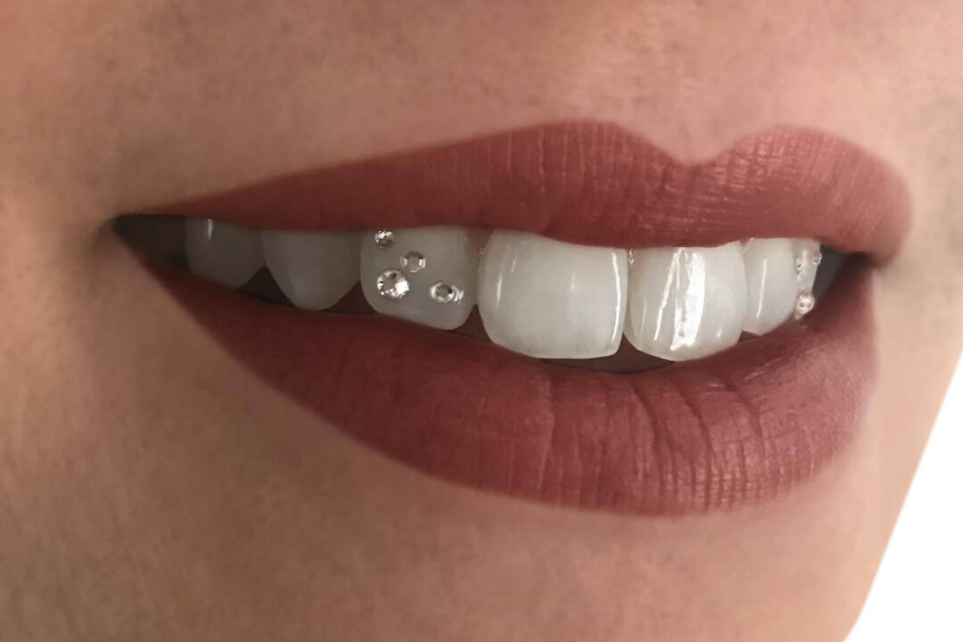 Tooth Jewelry